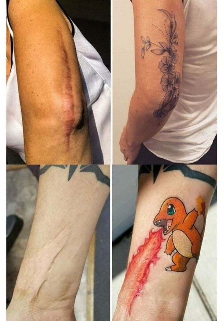 상처를 문신으로 승화시키기 | 인스티즈