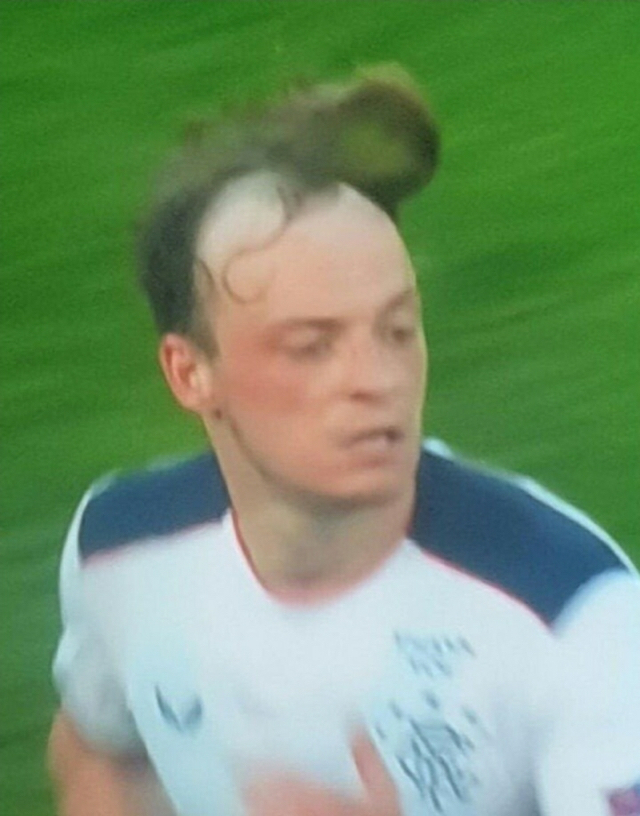 축구선수 중 탈모가 오면 머리 미는 사람이 많은 이유 | 인스티즈