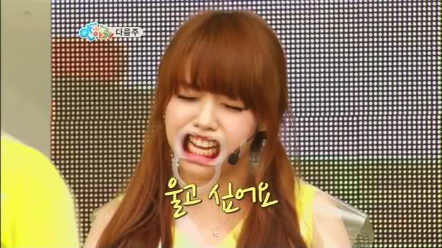 개구기로 보는 연예인 치열.jpg | 인스티즈