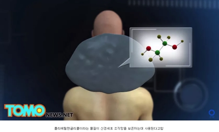 머리 이식 수술...jpg | 인스티즈