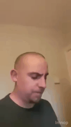 병원 수술용 마취제 셀프 테스트.gif | 인스티즈