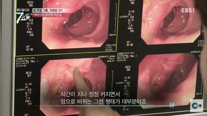 직장암3기 할아버지의 자존심 | 인스티즈