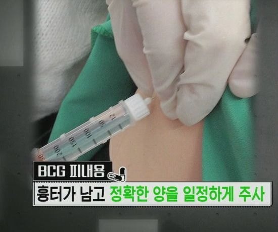 20대 초반 이하만 가지고 있다는 자국 (95년생~2000년생) | 인스티즈