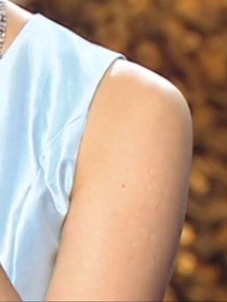 20대 초반 이하만 가지고 있다는 자국 (95년생~2000년생) | 인스티즈