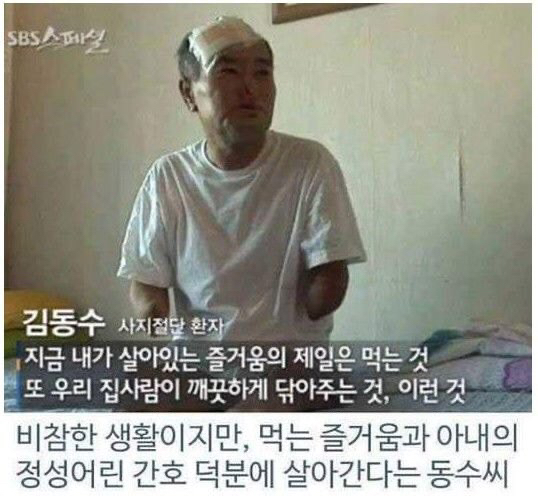 병원 실수로 하루아침에 사지 절단 | 인스티즈