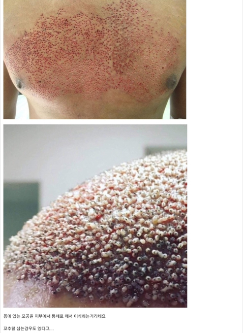 자라나라 모발모발 | 인스티즈