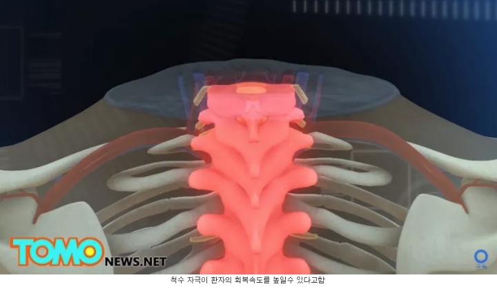 머리 이식 수술...jpg | 인스티즈