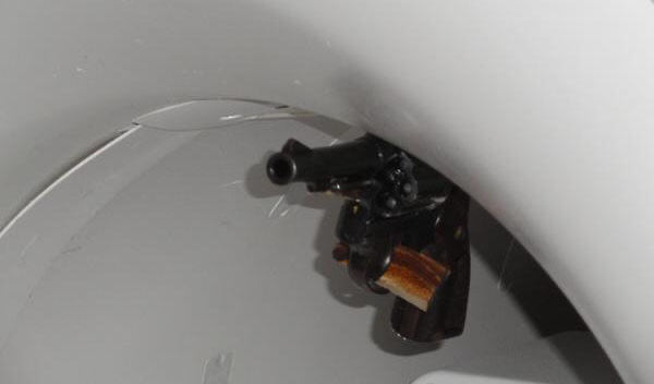 공포의 MRI 사고 사례.jpg | 인스티즈