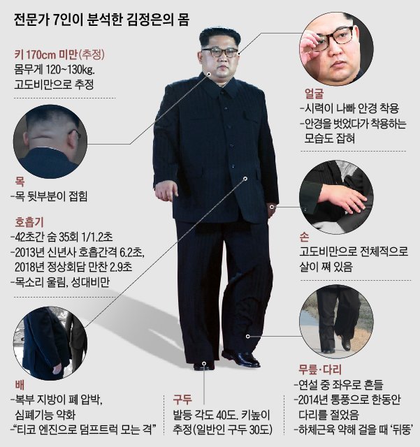 전문가 7명이 분석한 김정은의 몸...jpg | 인스티즈