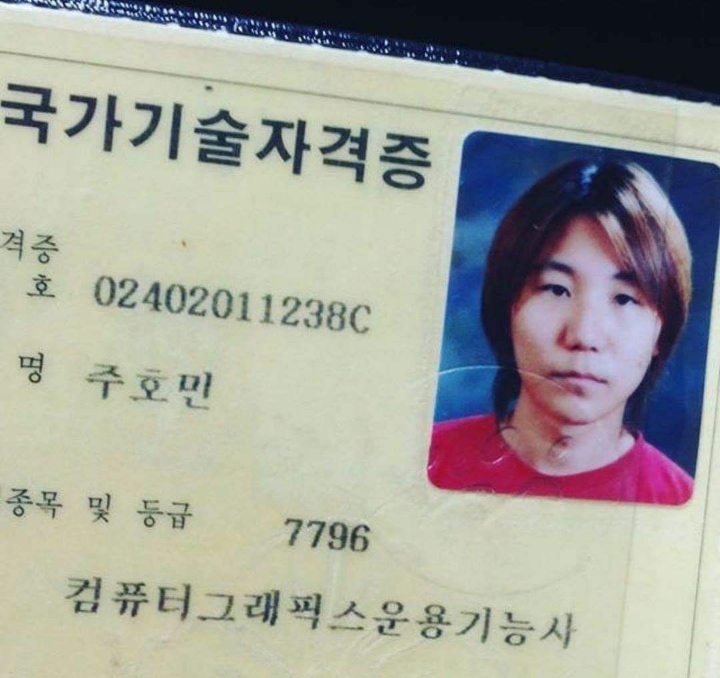 2030대가 머리숱 많다고 안심하면 안되는 이유 | 인스티즈