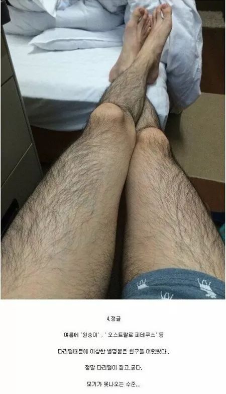 남자 다리털 유형 4가지 (혐오주의) | 인스티즈