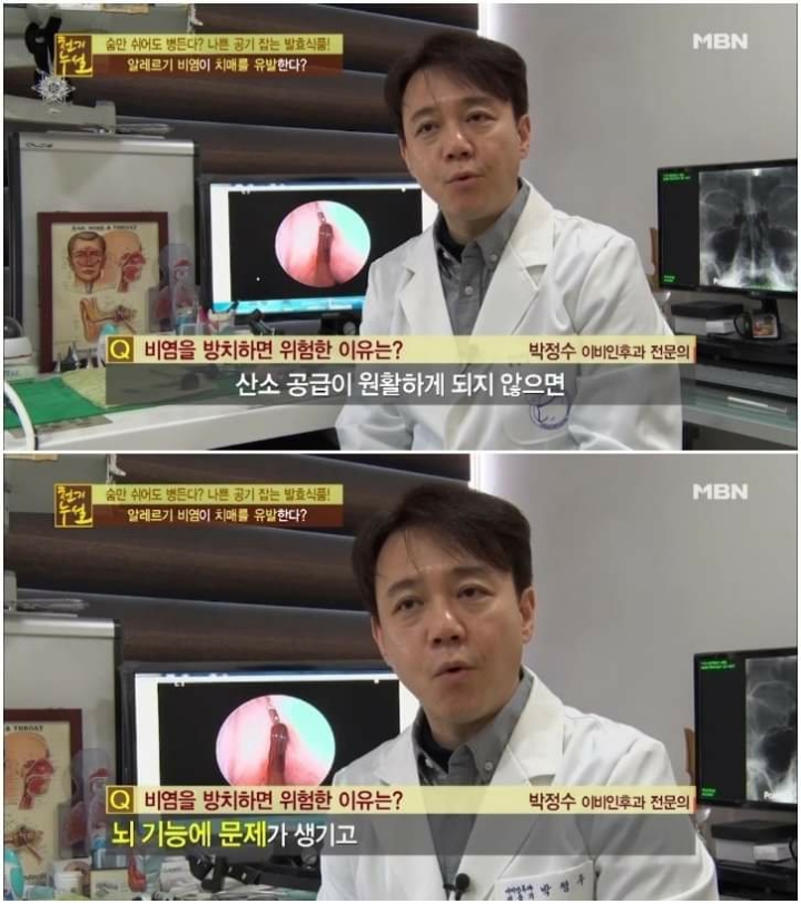 비염을 방치하면 안되는이유 | 인스티즈