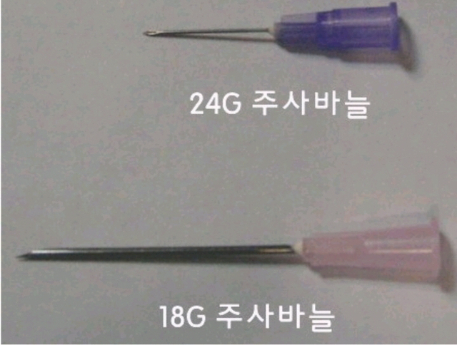 헌혈 주사바늘 특징.jpg | 인스티즈
