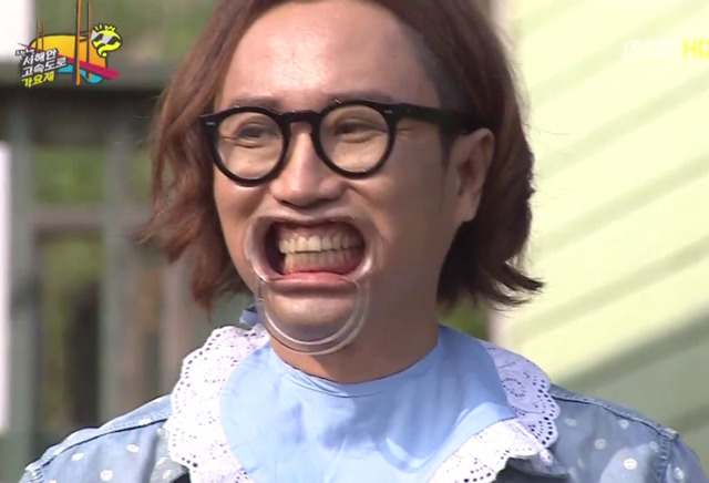 개구기로 보는 연예인 치열.jpg | 인스티즈