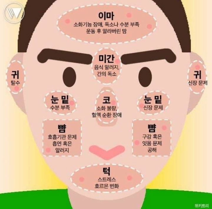 얼굴에 여드름 나는 이유.JPG | 인스티즈