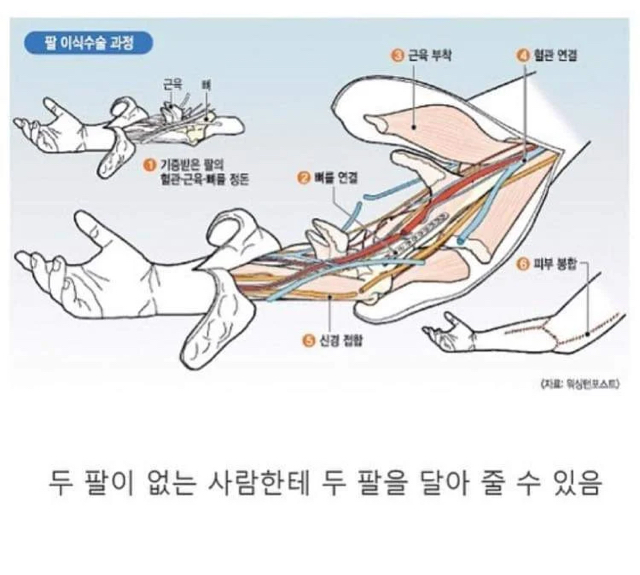 현대의학으로 가능한 것과 불가능한 것 | 인스티즈