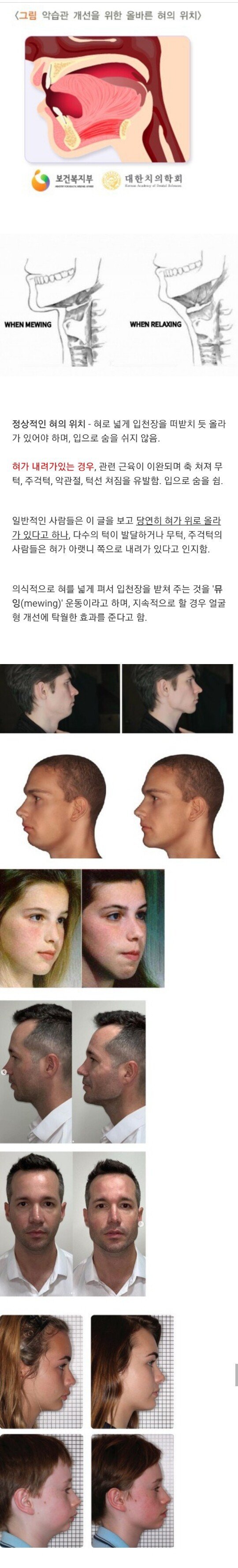 얼굴형이 바뀐다는, 올바른 혀의 위치 | 인스티즈