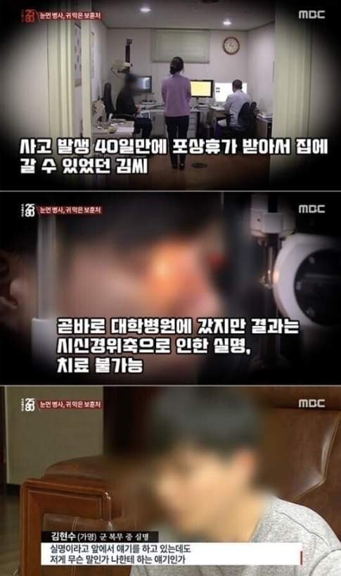 군대가서 다치면 나만 손해인 이유 | 인스티즈