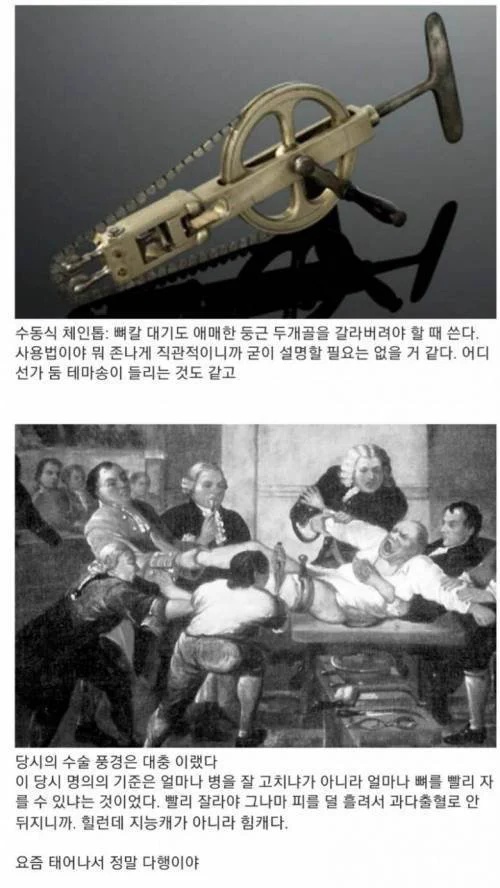 서양에서 한동안 외과의사 취급이 안좋았던 이유 | 인스티즈