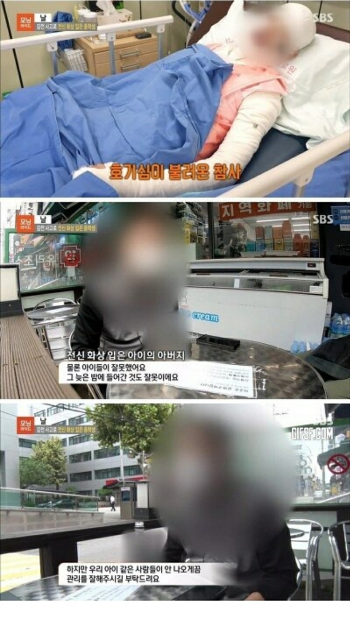 감전 사고로 전신 화상 입은 중학생.jpg | 인스티즈