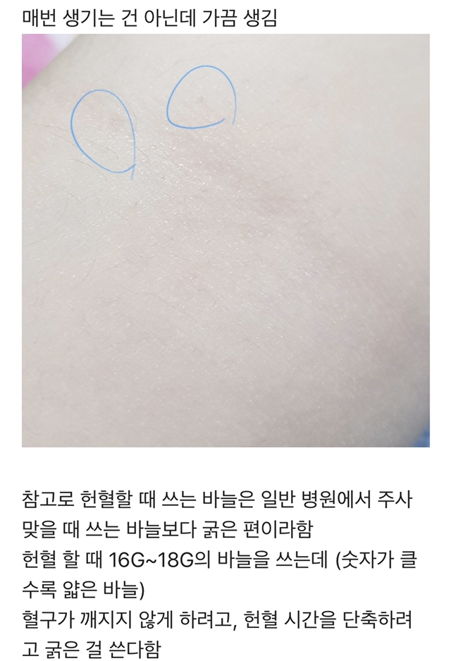 헌혈 주사바늘 특징.jpg | 인스티즈