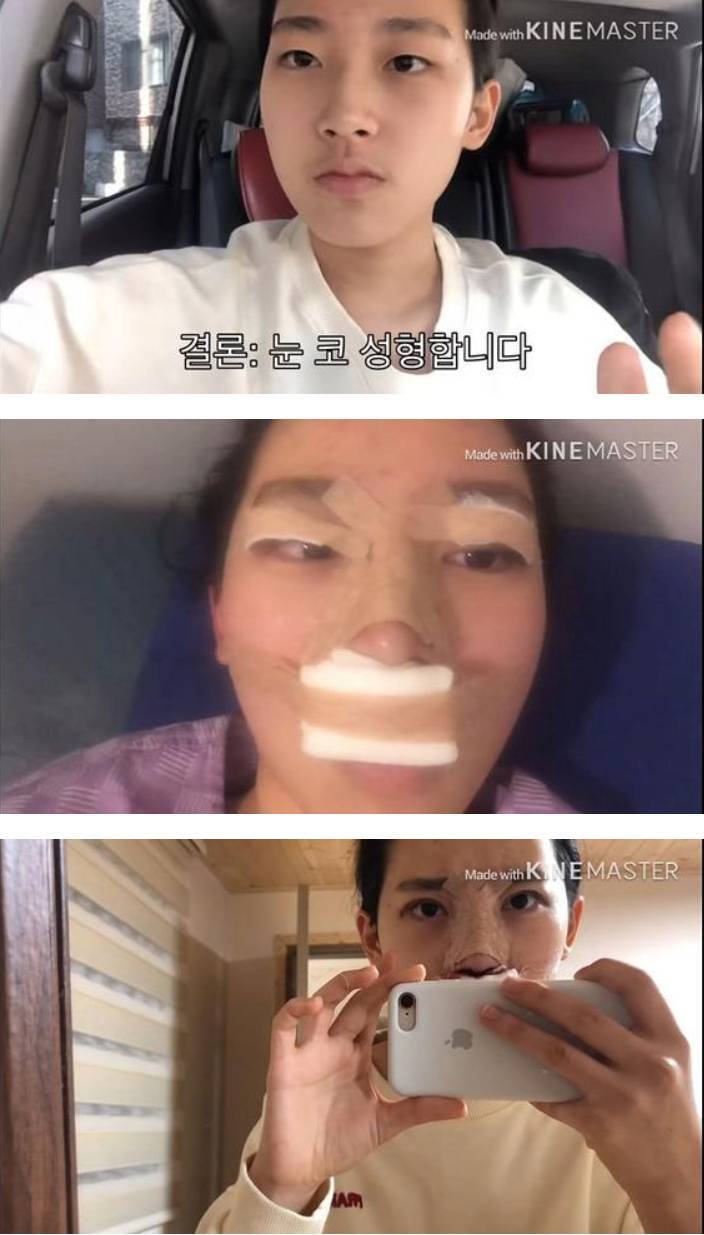 눈코 성형한 여고생 | 인스티즈