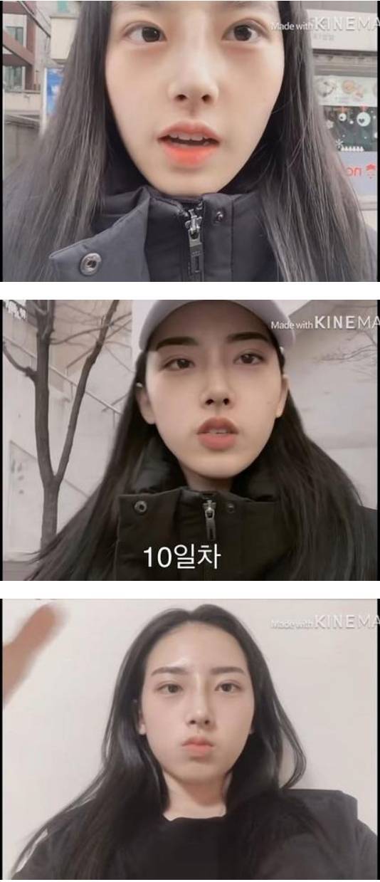 눈코 성형한 여고생 | 인스티즈