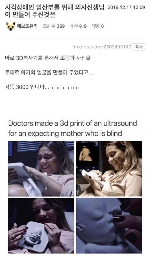 시각장애인 임산부를 위해 의사선생님이 만들어 주신것은 | 인스티즈