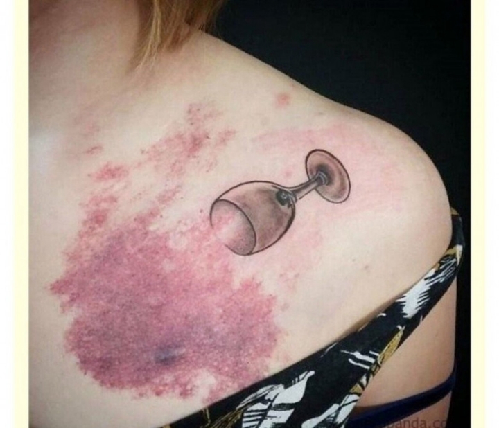 상처를 문신으로 승화시키기 | 인스티즈