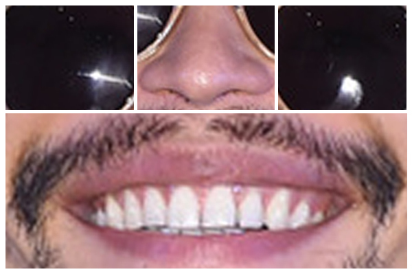 눈.코.입보고 연예인 맞히기2 | 인스티즈