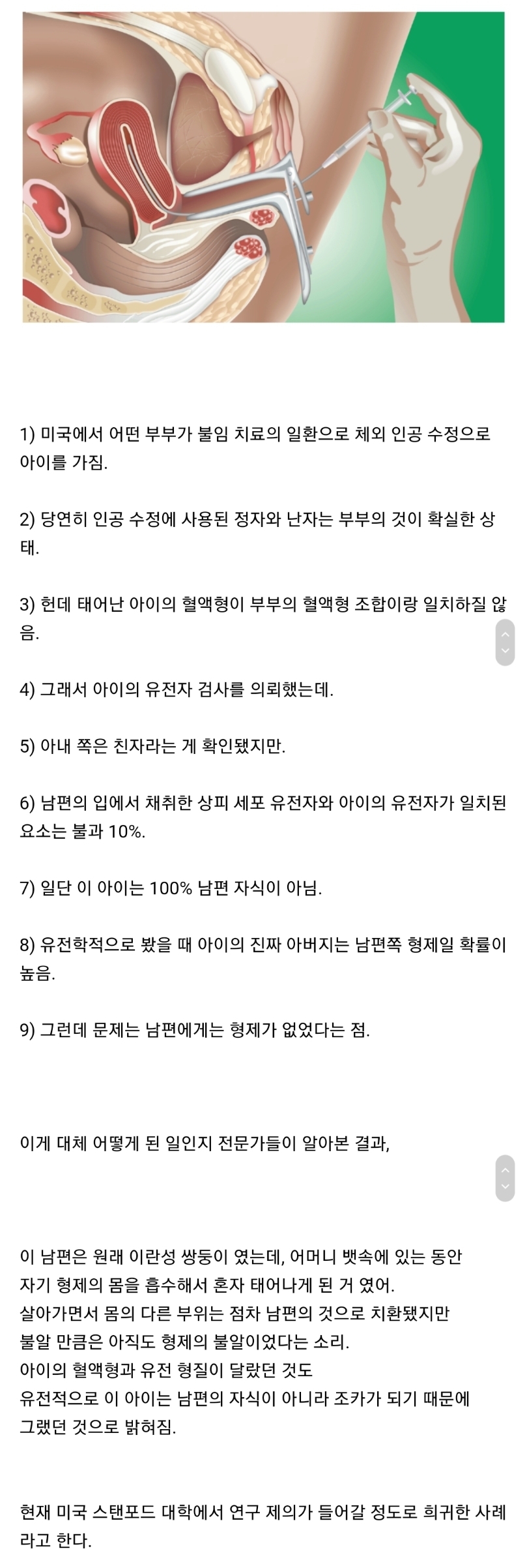 인공수정 했는데 내 아들이 아니다 | 인스티즈