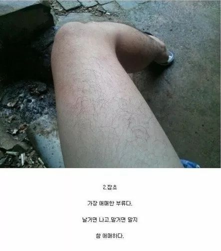 남자 다리털 유형 4가지 (혐오주의) | 인스티즈