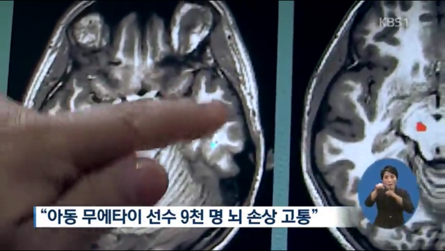 애들을 돈벌이로 경기에 내보낸다는 태국 (13살 소년 사망) | 인스티즈