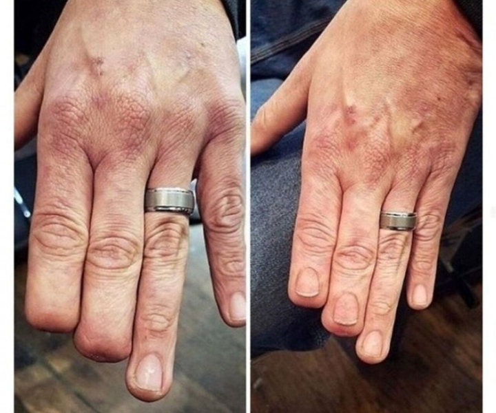 상처를 문신으로 승화시키기 | 인스티즈