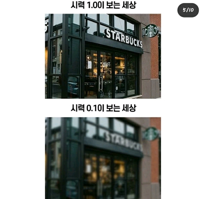 시력 1.0과 0.1의 차이 | 인스티즈