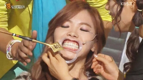 개구기로 보는 연예인 치열.jpg | 인스티즈