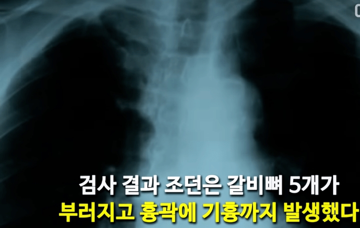 18m 높이의 다리 위에서 친구를 밀어버린 싸이코패스 | 인스티즈