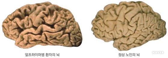 이 세상에서 둘중 하나만 없앨수 있다면?.JPG | 인스티즈