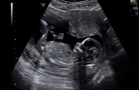 아이즈원 멤버들 데뷔확정의 순간 | 인스티즈