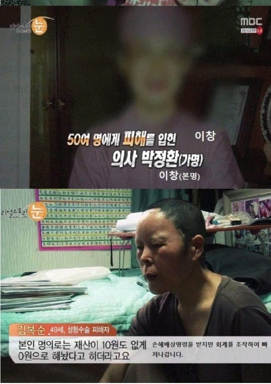 일부러 수술을 망치는 사이코패스 의사 | 인스티즈