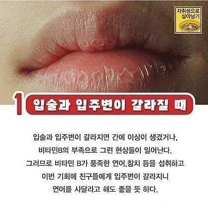 면역력 결핍일때 몸이 보내는 신호 | 인스티즈