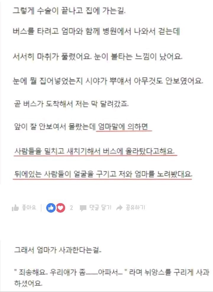 한 여자분의 쌍수후기 | 인스티즈