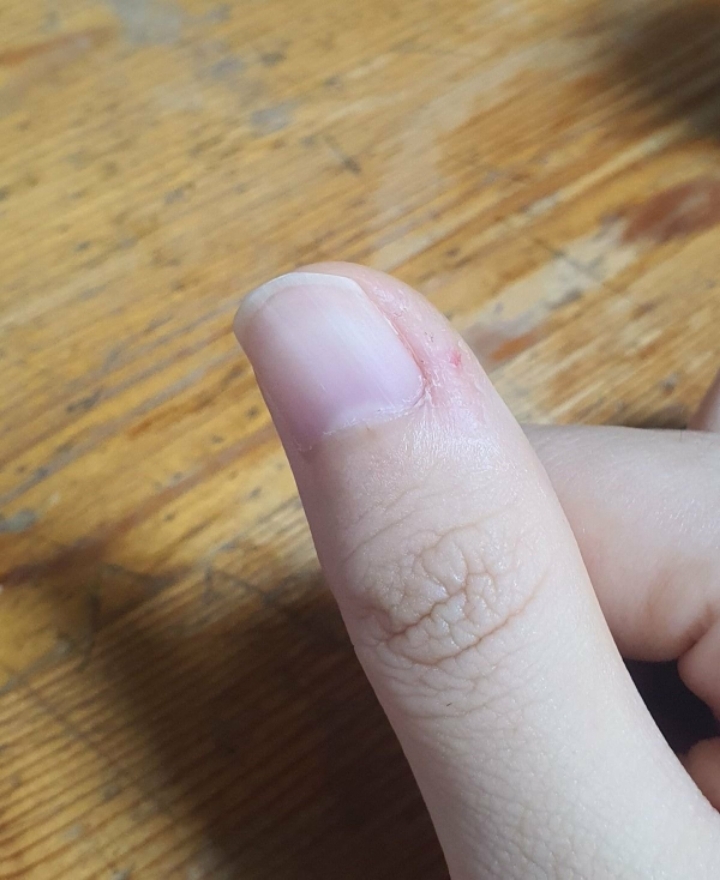손톱은 안뜯어도 이거 뜯는 습관 있는 사람 많음.jpg | 인스티즈
