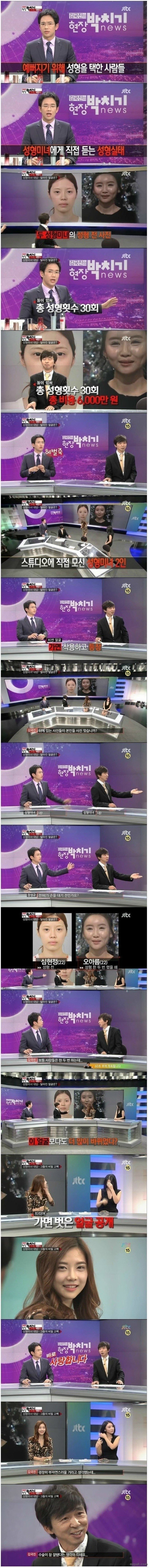 성형수술 30번한 여자 | 인스티즈