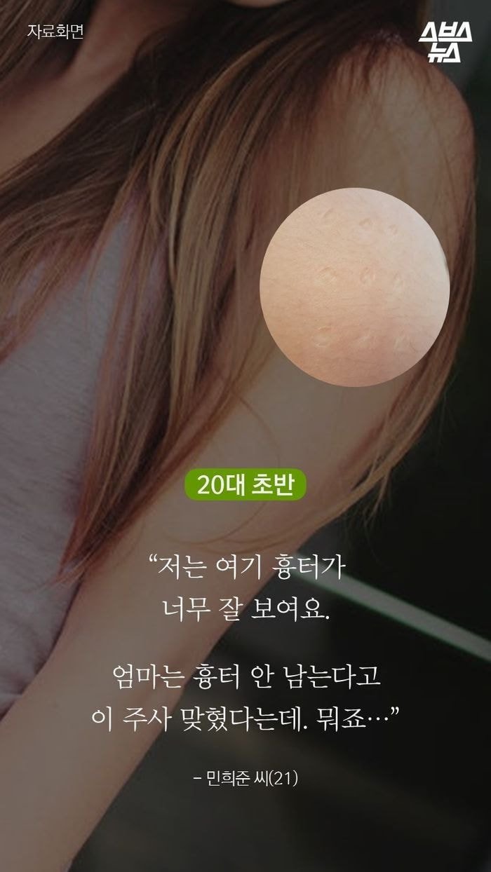 20대 초반 이하만 가지고 있다는 자국 (95년생~2000년생) | 인스티즈