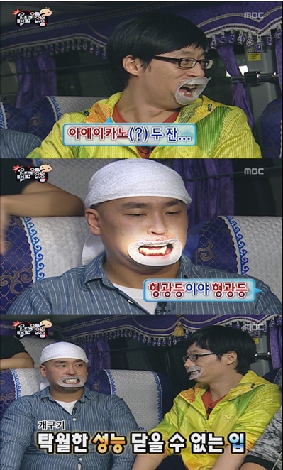 개구기로 보는 연예인 치열.jpg | 인스티즈