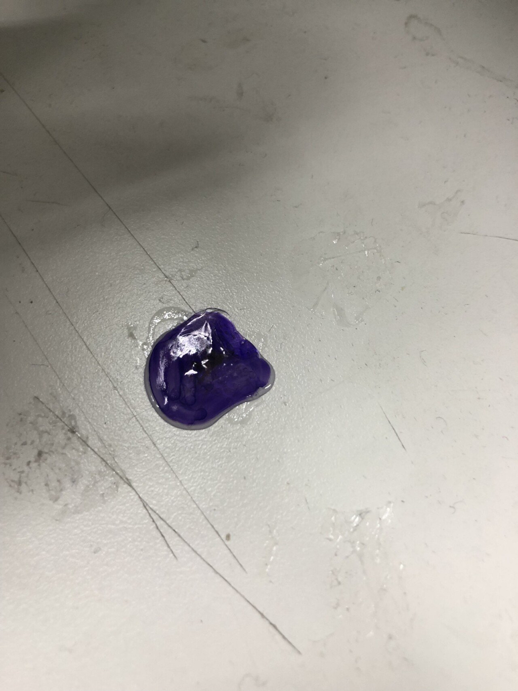 모기 새끼 다양하게 고문하는 모기 갤러리.jpgif | 인스티즈