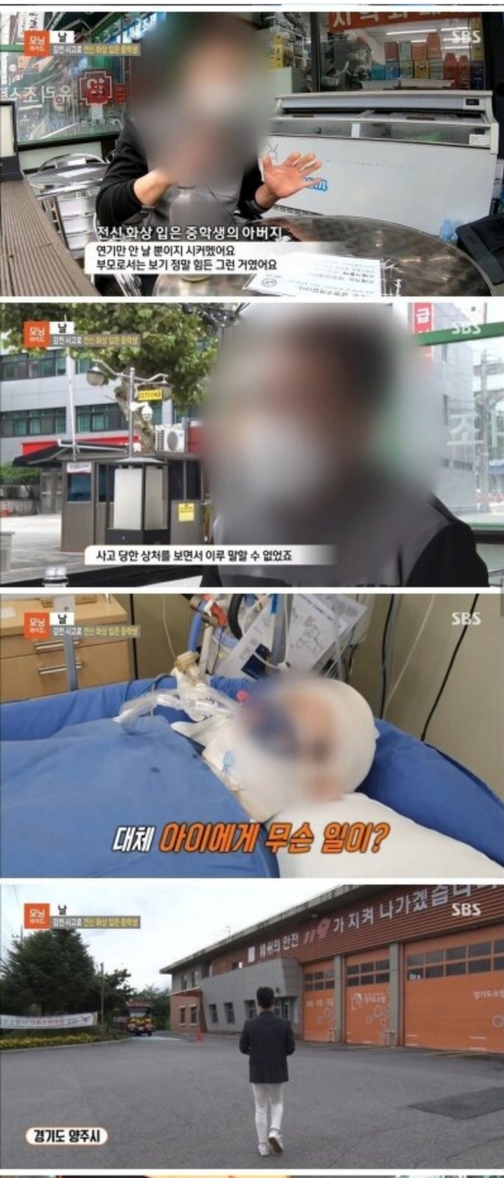 감전 사고로 전신 화상 입은 중학생.jpg | 인스티즈