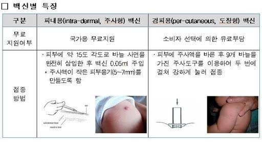 20대 초반 이하만 가지고 있다는 자국 (95년생~2000년생) | 인스티즈