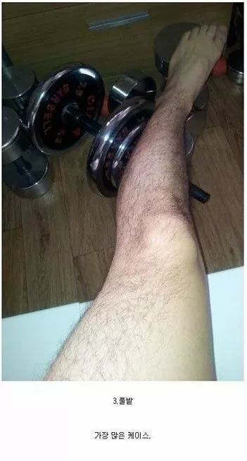 남자 다리털 유형 4가지 (혐오주의) | 인스티즈